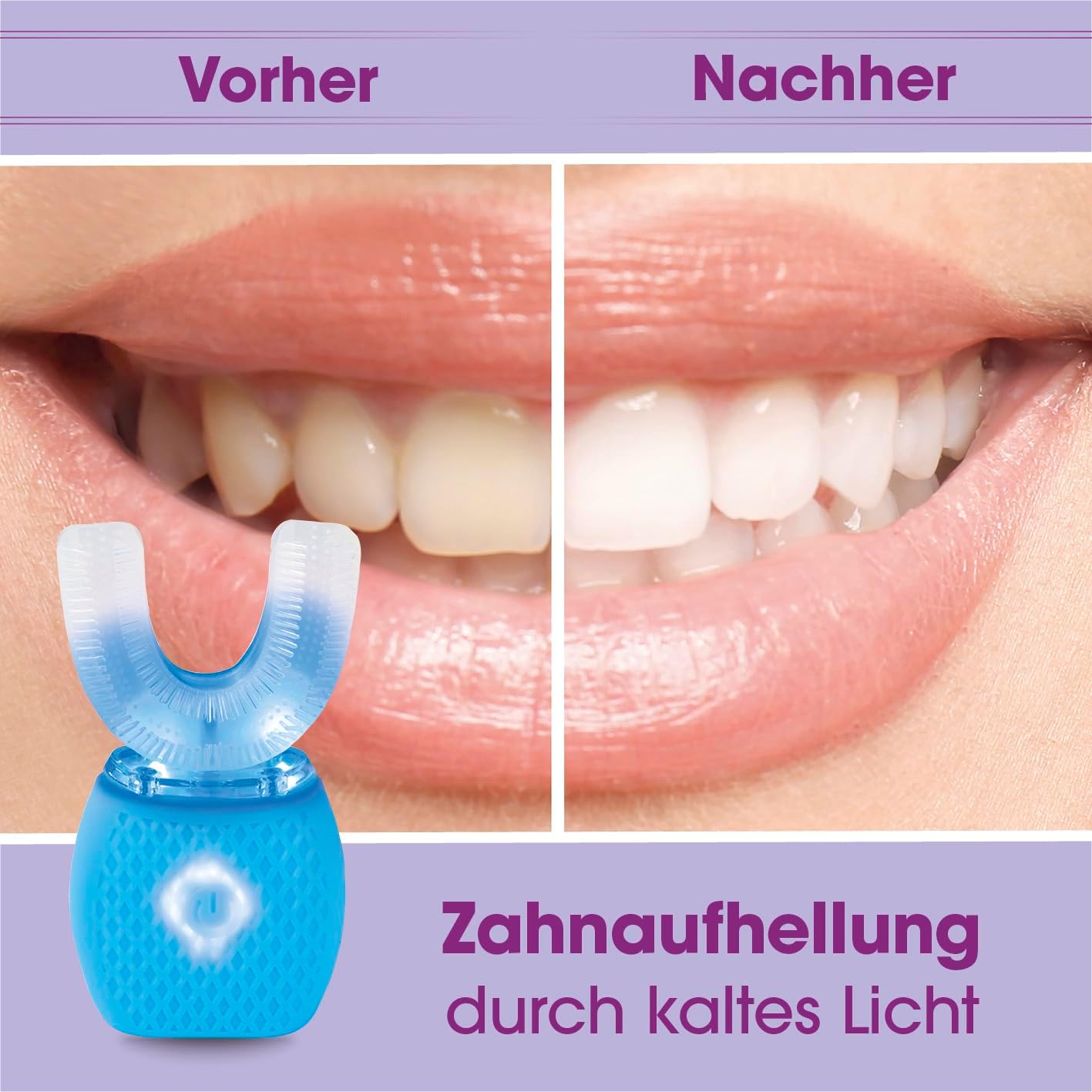 VITALmaxx 360° Schall-Zahnbürste mit 4 Modi | Freihändiges Putzen | 15.000 Schallschwingungen | Weiche Silikon-Borsten + Zahnfleischmassage | Schnelle & gründliche Reinigung | USB-Ladung — Ansicht 4